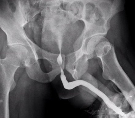 rgu x ray 2