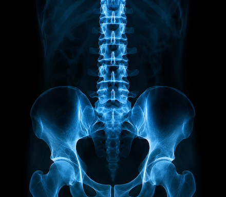 xray